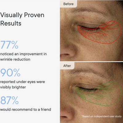 Micro-Infusion Targeted Patches