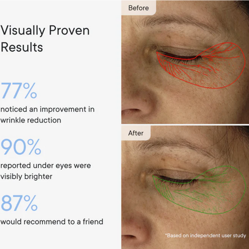 Micro-Infusion Targeted Patches