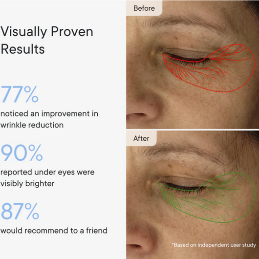 Micro-Infusion Targeted Patches
